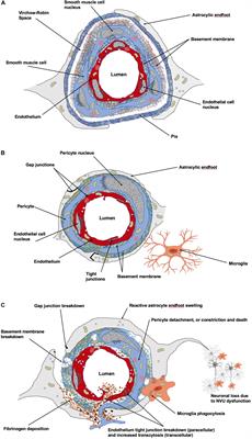 Structural and Functional Remodeling of the Brain Vasculature Following Stroke